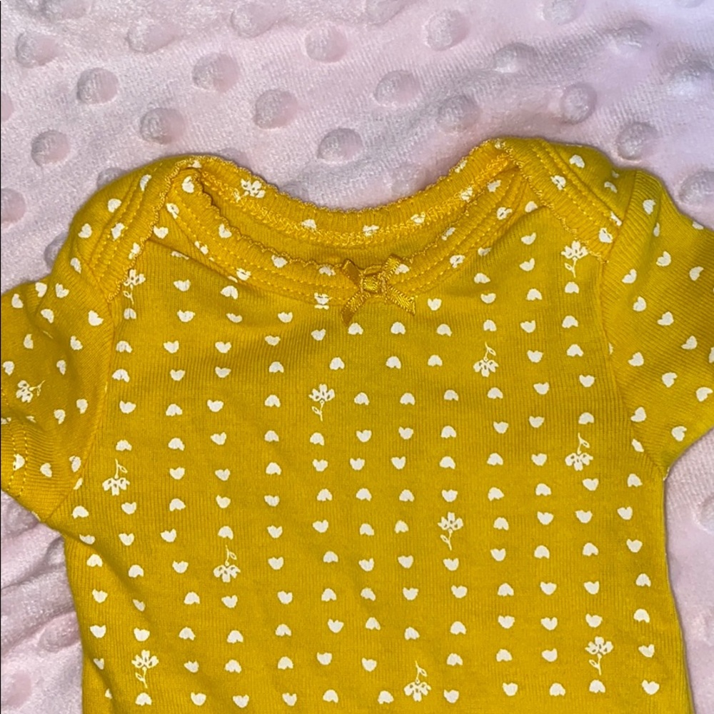 Onesie - Picture 2 of 2